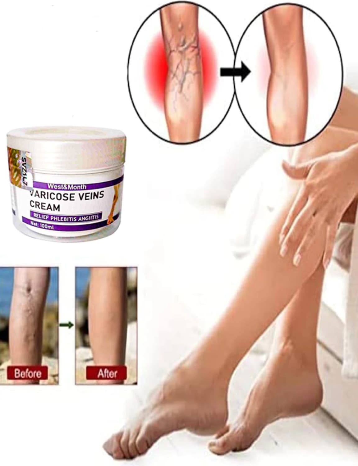 Varicose And Spider Veins Soothing Leg Cream Bacakkremi 100 ml