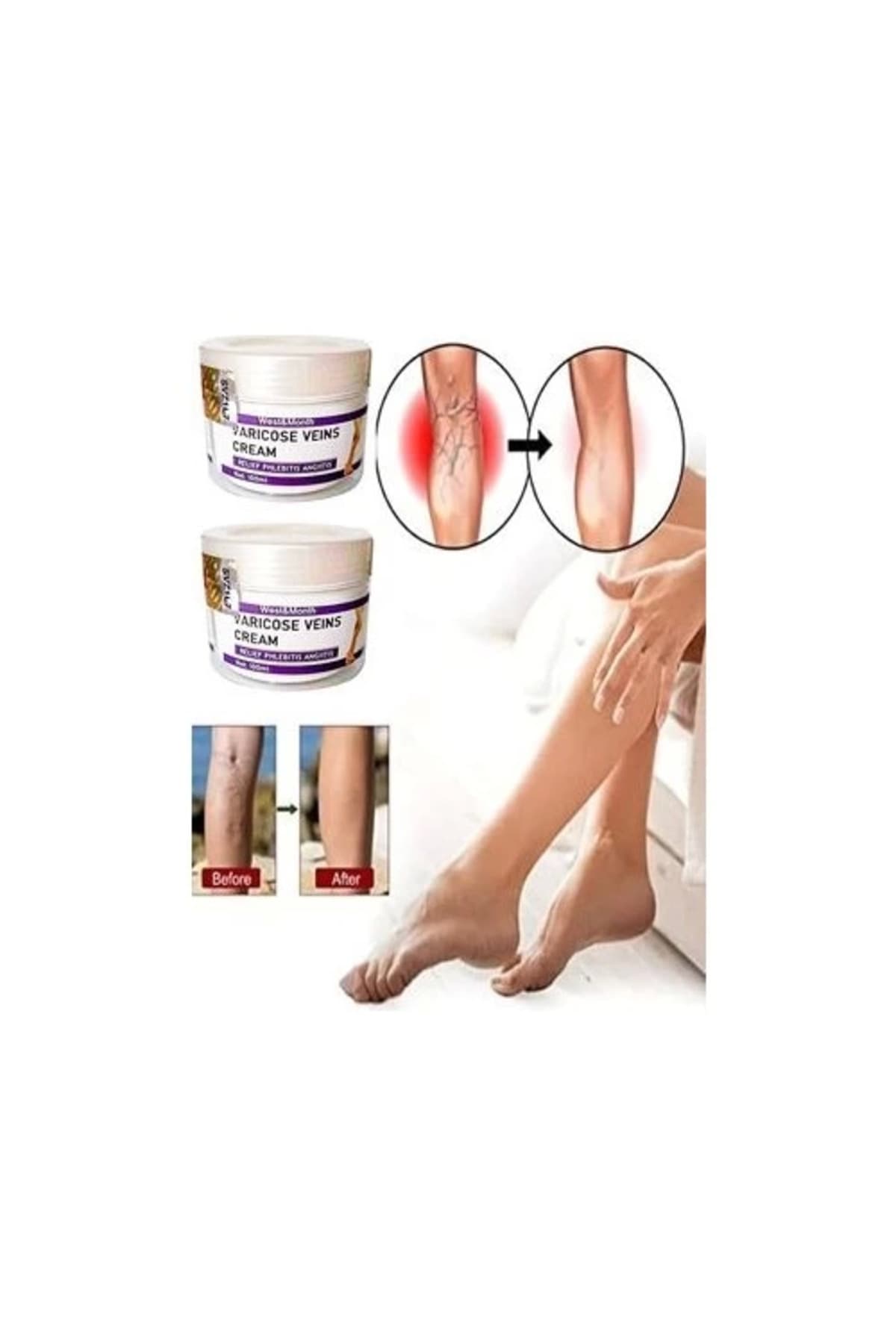 Varicose And Spider Veins Soothing Leg Cream Bacak Bakım Kremi 100 ml x 2 Adet