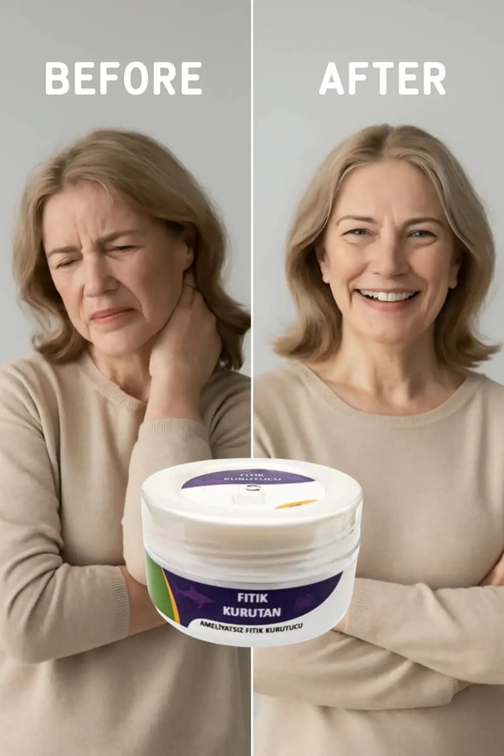 Süper Fıtık Kurutan Krem 50 ml