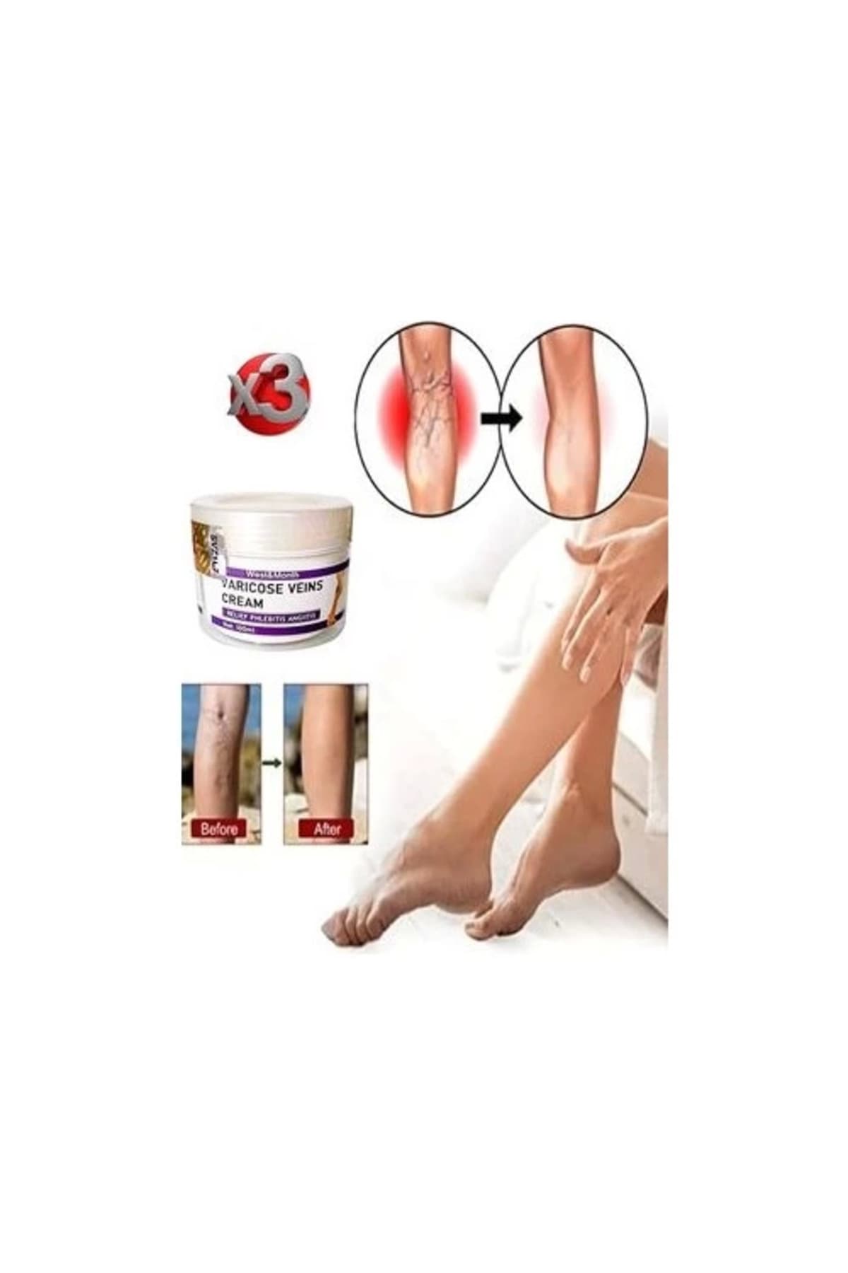 Varicose And Spider Veins Soothing Leg Cream Bacak Bakım Kremi 100 ml x 3 Adet