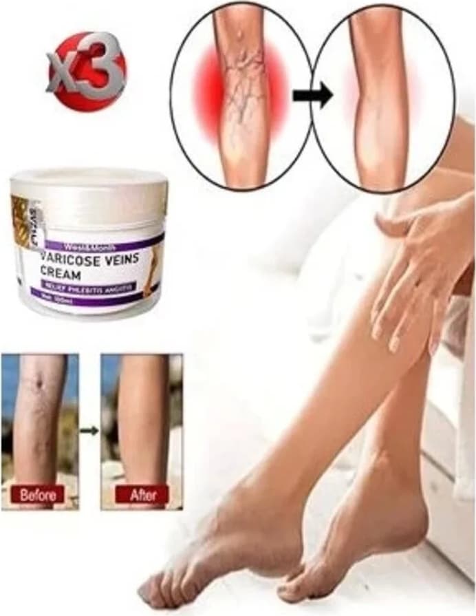 V.ricose And Spider Vns Sthing Leg Cream Bacak Bakım Kremi 100 ml x 3 Adet