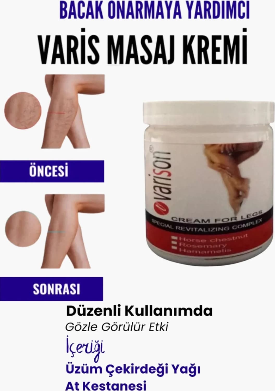 Bölgesi Için Bacak Yardımcı ve Varison Masaj Kremi 200 ml