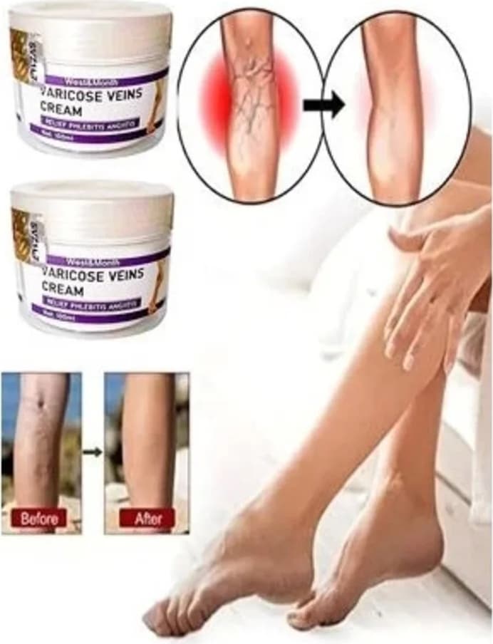 V.ricose And Spider Vns Sthing Leg Cream Bacak Bakım Kremi 100 ml x 2 Adet