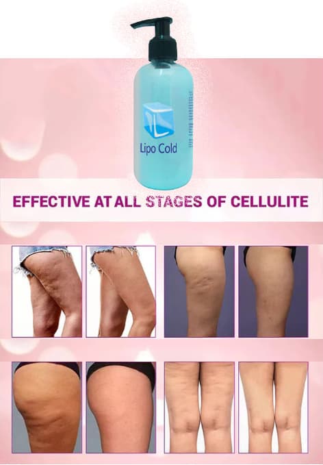 Lipo Cold Fazlalaşan Yağlarınızdan ve Selülitlerinizden Kurtulmaya Karşı Krem 250 ml