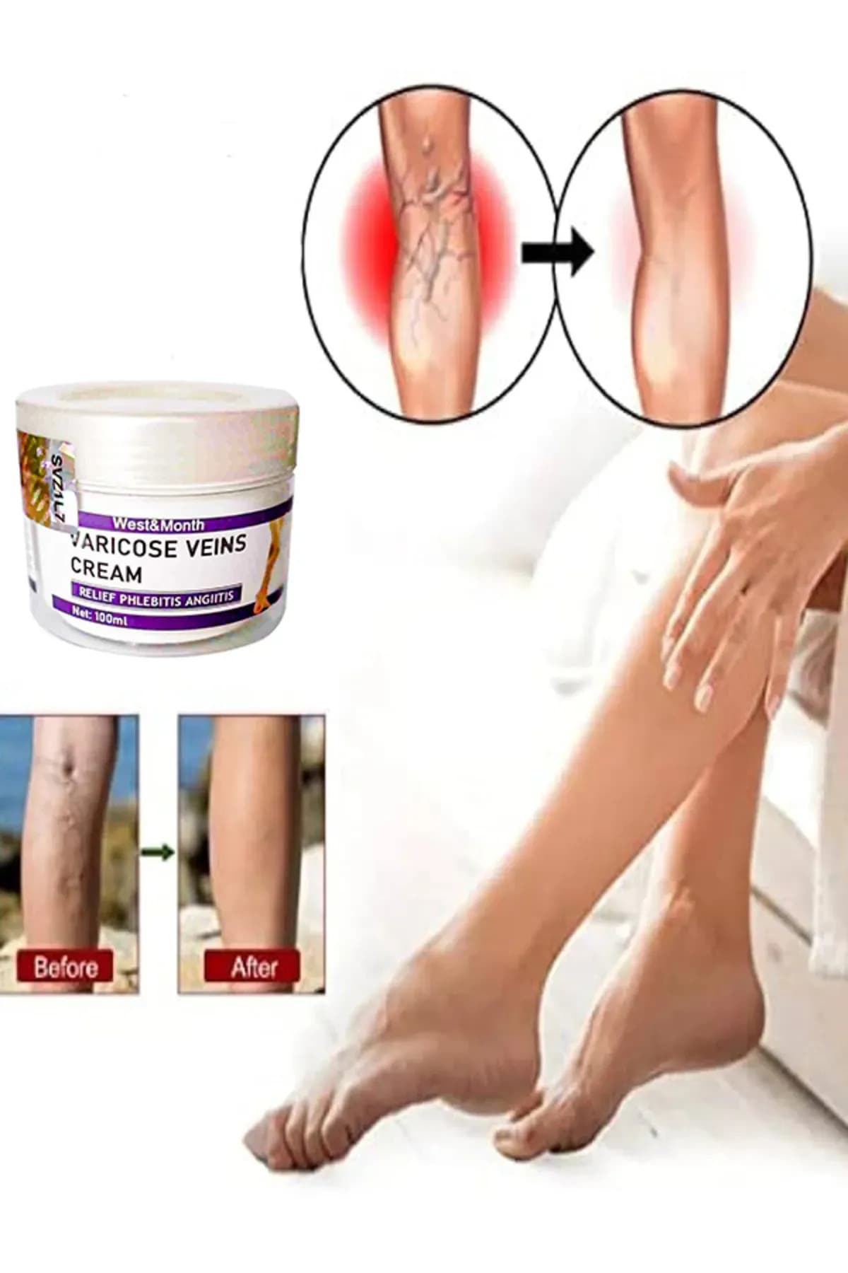 Cream West&Month Selülit Karşıtı Bacak Önleyici Bakım Kremi 100 ml X 3 ADET