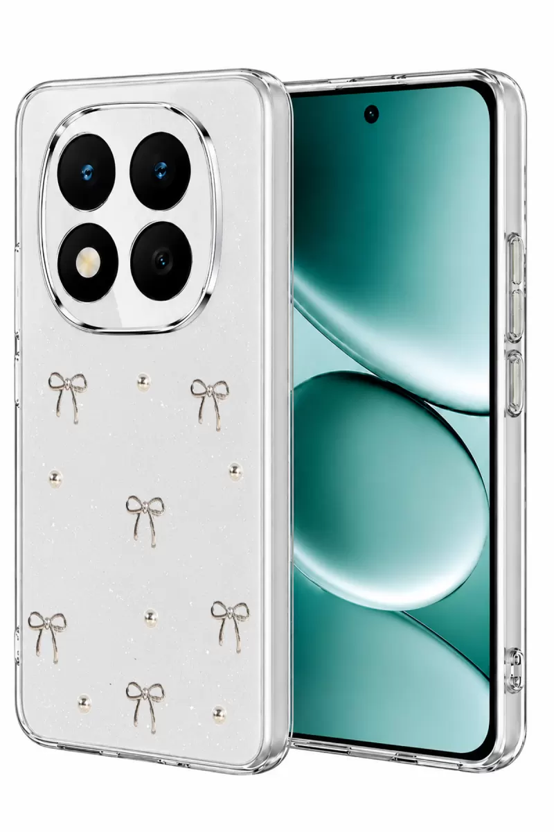 Note 15 Pro 5G Fiyonk Desenli Kapak - Desen 5
