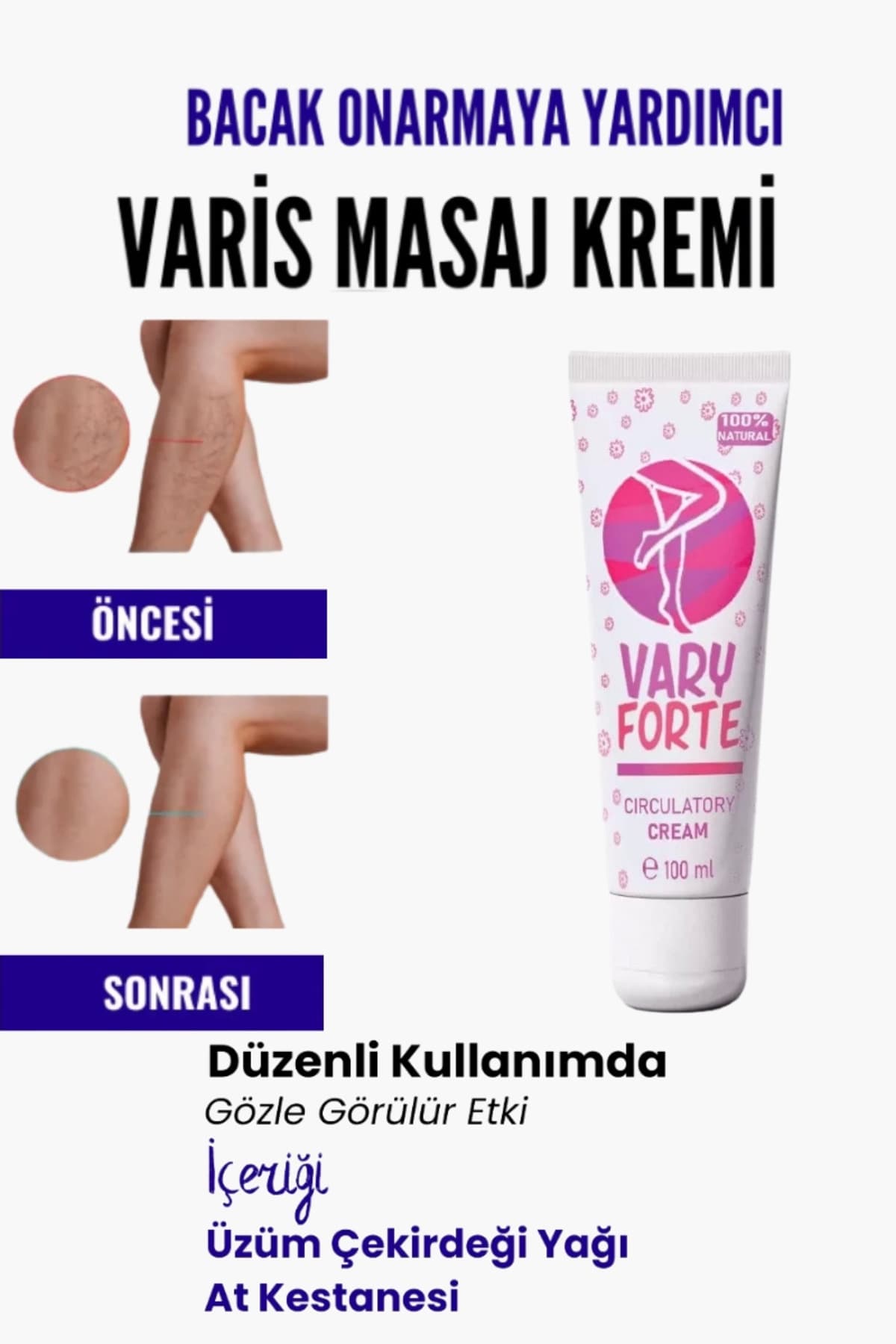 Var.is Bölgesi Için Bacak Onarmaya Yardımcı Besleyici Varyforte Masaj Kremi 100ml