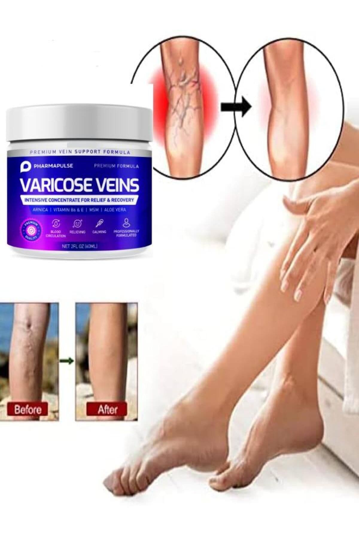 Maximum Strength Varicose Vein Var.is Bacak Bakım Masaj Kremi 100 ml 2 Adet