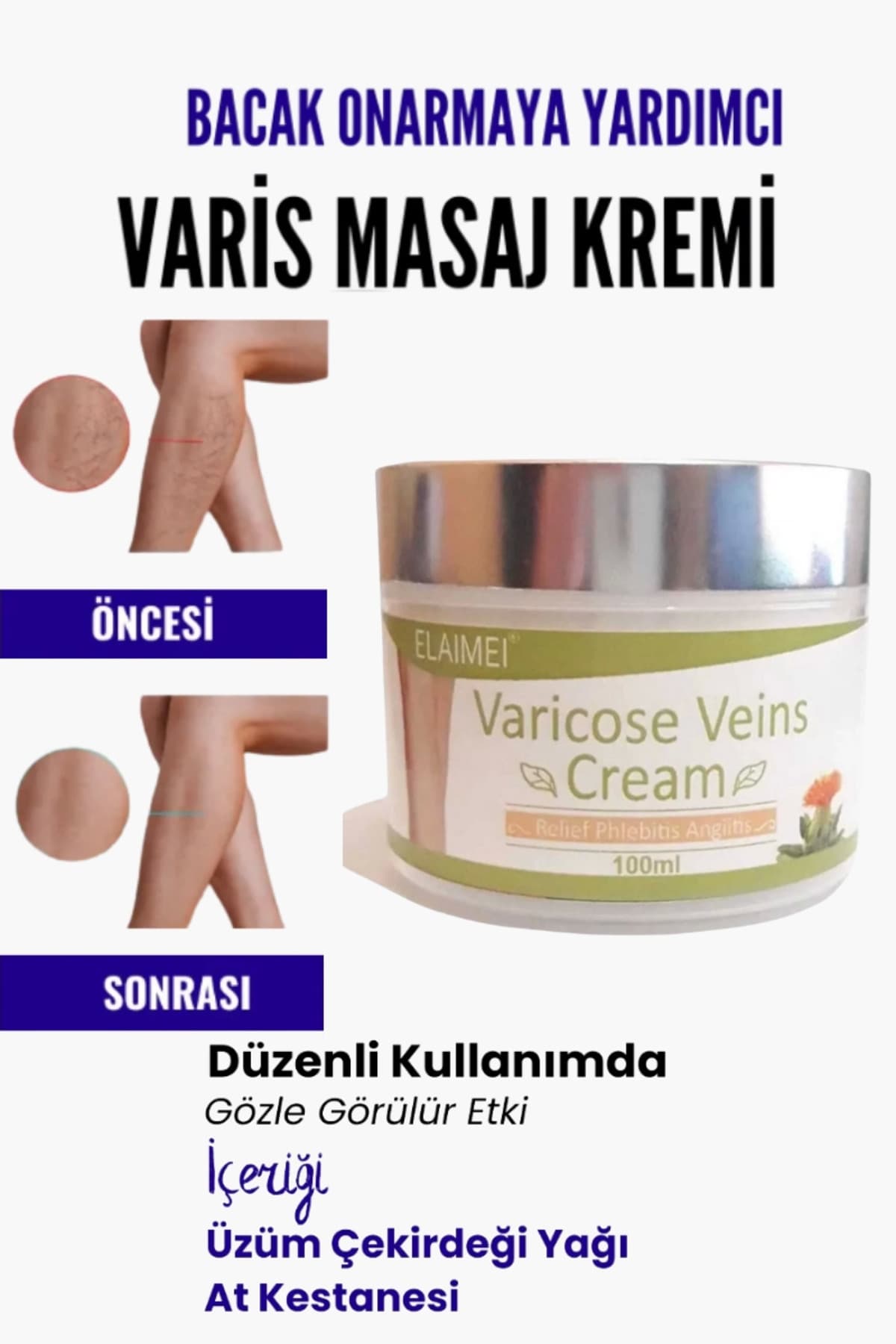 Var.is Bölgesi Için Bacak Onarmaya Yardımcı Ve Besleyici Varicose Masaj Kremi 100 ml