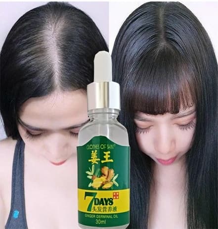7Days 30ML Gingergerminalessentialoil Hair Growth Loss Treatment Serum Unisex 3 Adet Saç Bakım Yağı