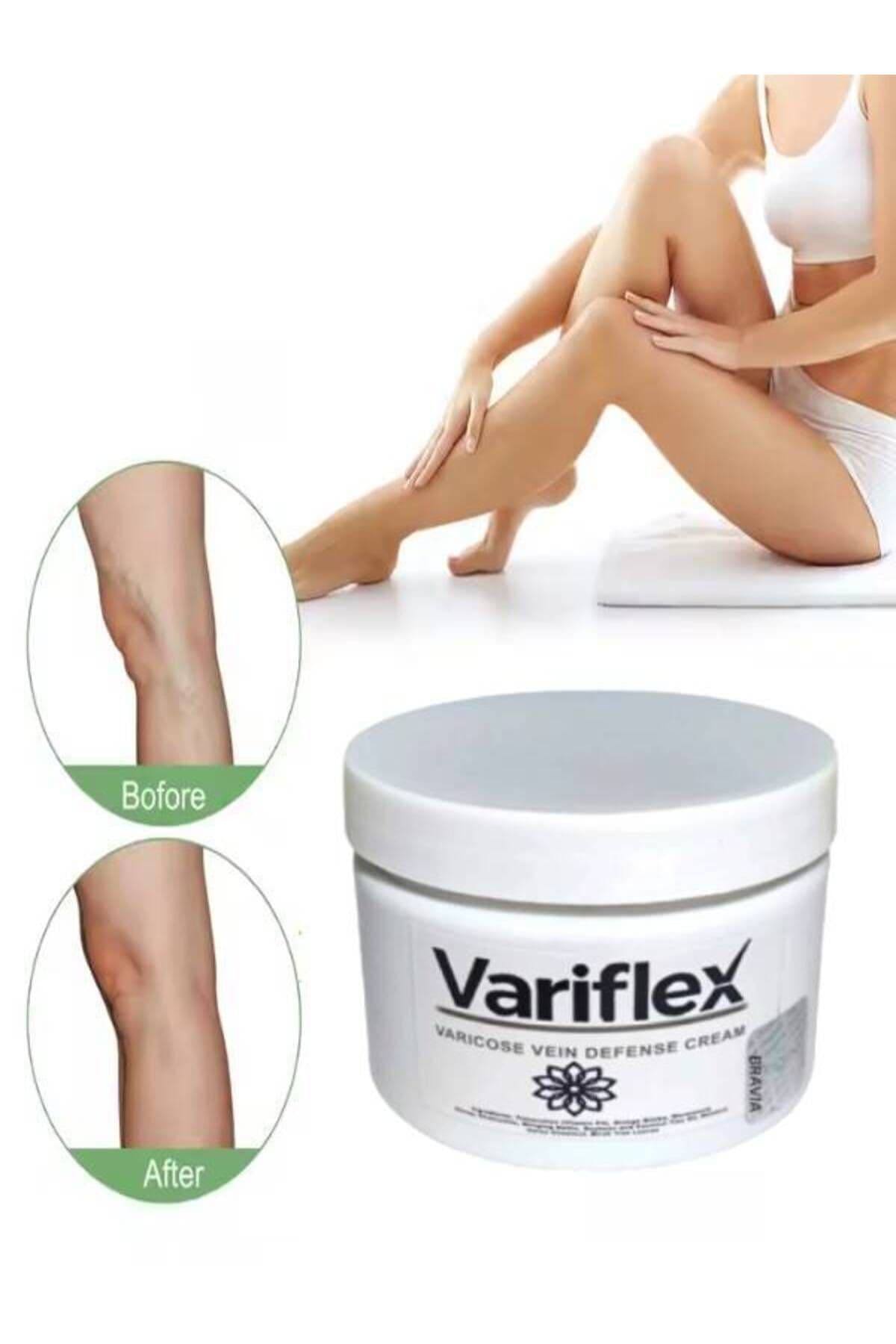 Variflex Varicose Vein Defense Bacak Var.isleri Için Masaj Bakım Kremi 150 ml