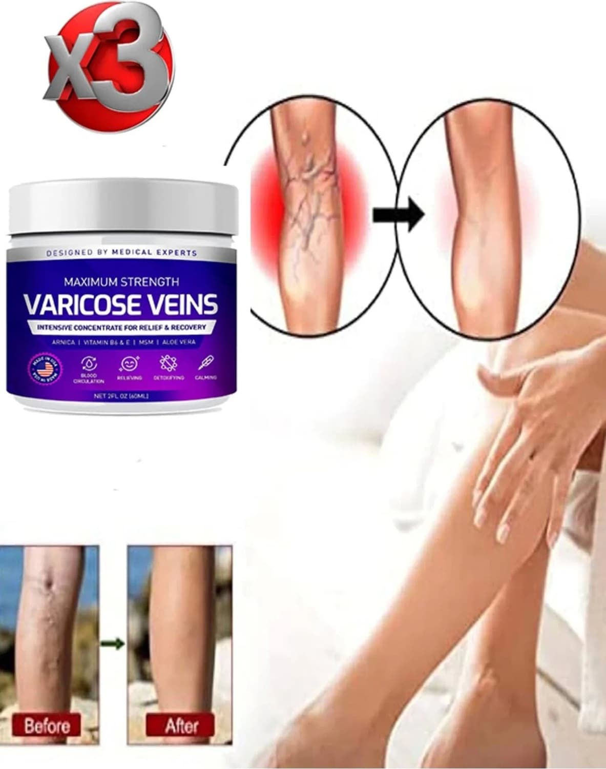 Süper Maximum Strngth Varcse Vnis Bakım Kremi 100 ml x 3 Adet